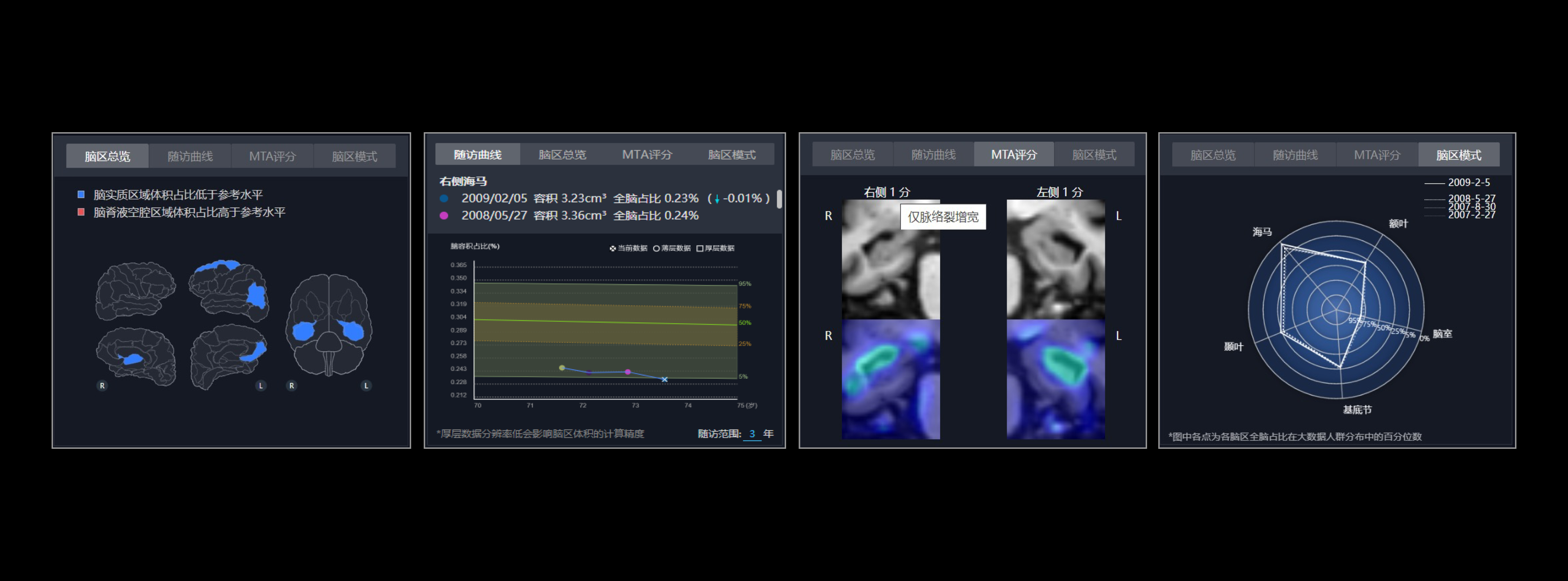 提供随访曲线、脑区总览、MTA评分、脑区模式。实现病程跟踪随访展示；提示全脑体积异常区域；自动得出MTA评分，评估内侧颞叶萎缩程度辅助临床诊断；提供关键脑区的体积变化模式辅助分辨痴呆亚型
