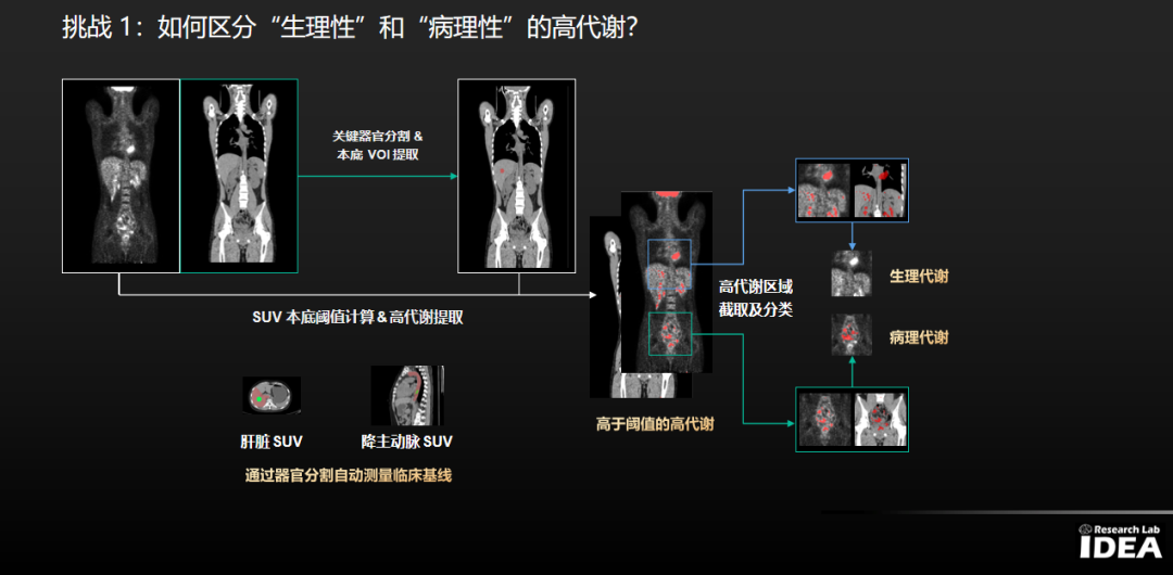 2023 中华核医学学术年会 | 沈定刚教授演讲：AI 在核医学领域大有可为