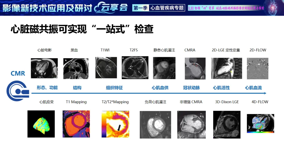 安贞医院影像科徐磊教授：医疗AI 在心脏磁共振领域潜力无限
