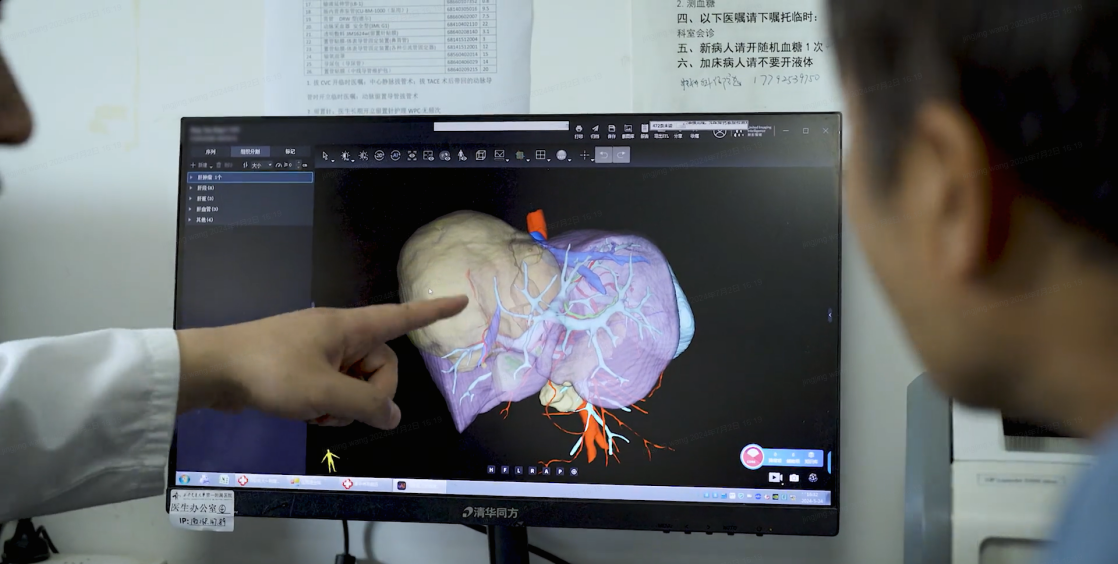 西安交大一附院以「全院级项目」引入联影智能肝脏重建AI人工智能诊断系统